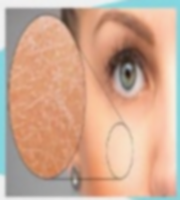 Tratamiento de hidratación profunda